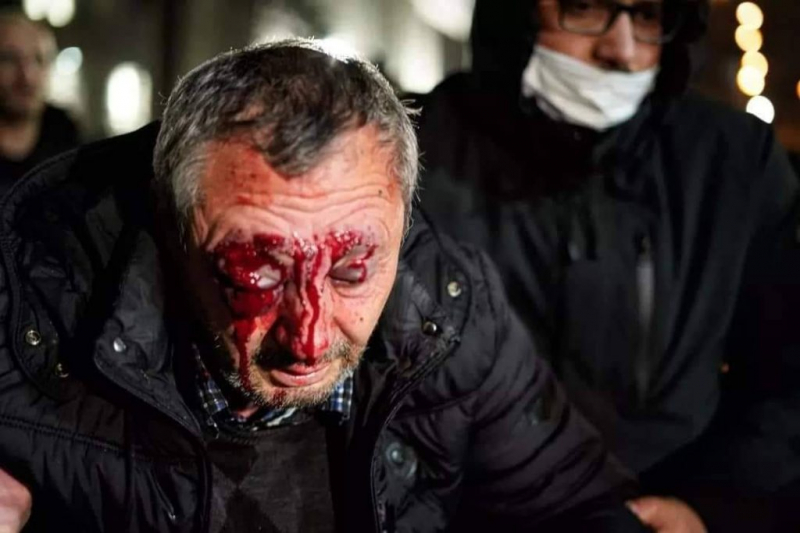 Участник акции протеста в Тбилиси потерял зрение — МВД обещает расследование
