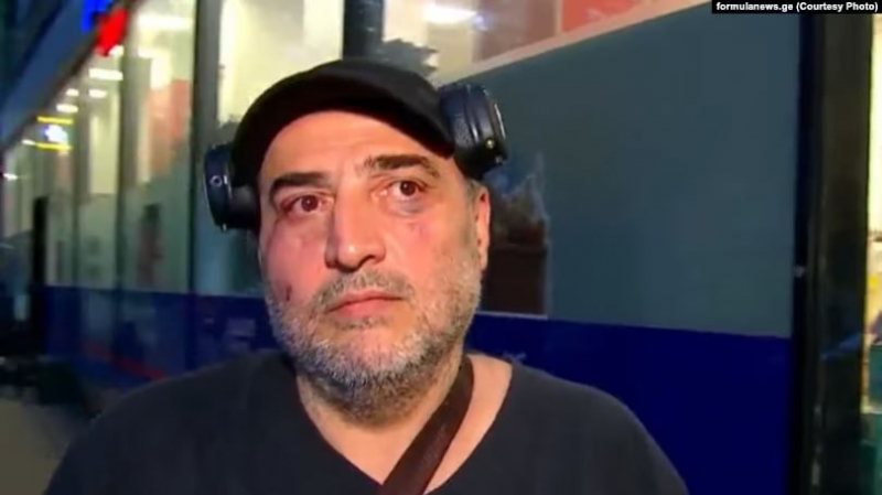В Тбилиси напали на основателя телеканала “Формула” – МВД начало следствие